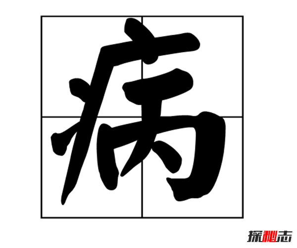 墩布手是什么?四川唐光喜墩布手困扰14年(共重15斤)